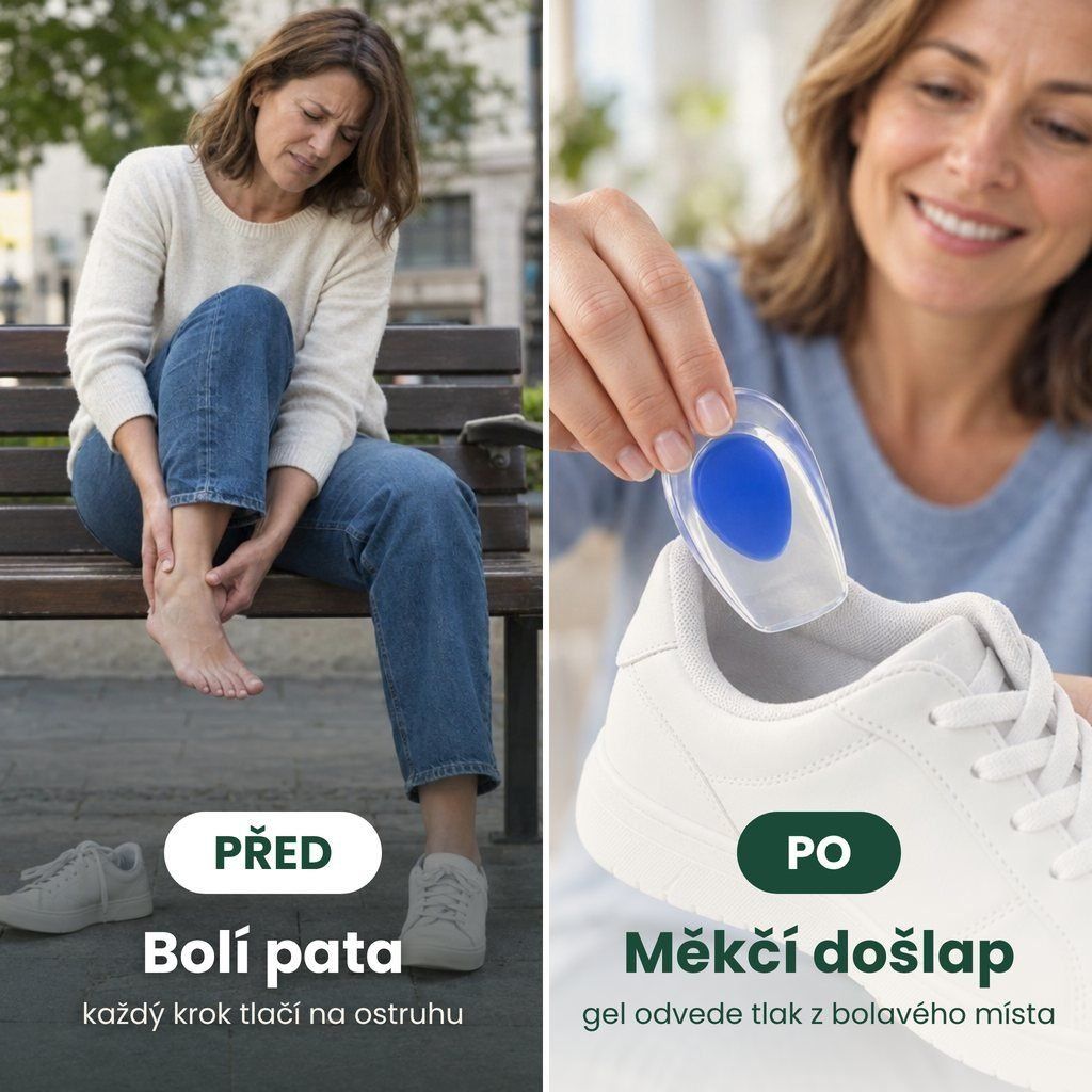 Gelové patní misky před a po – bolest paty a měkčí došlap